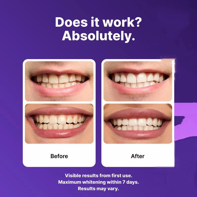 Purple Teeth Whitening 14 Strips